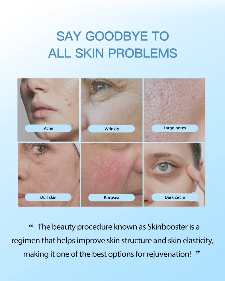 Meso Secret® Skinbooster Hyaluronic Acid 3.5ml * 2 Vials