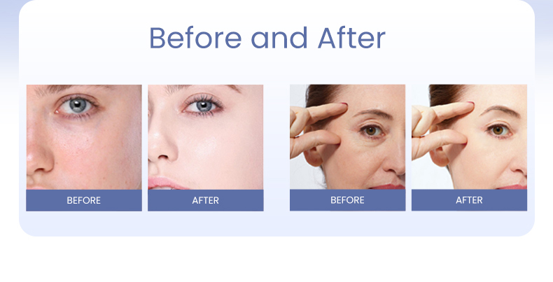 Meso Secret® Hydro PDRN Skinbooster 2.5ml/syringe