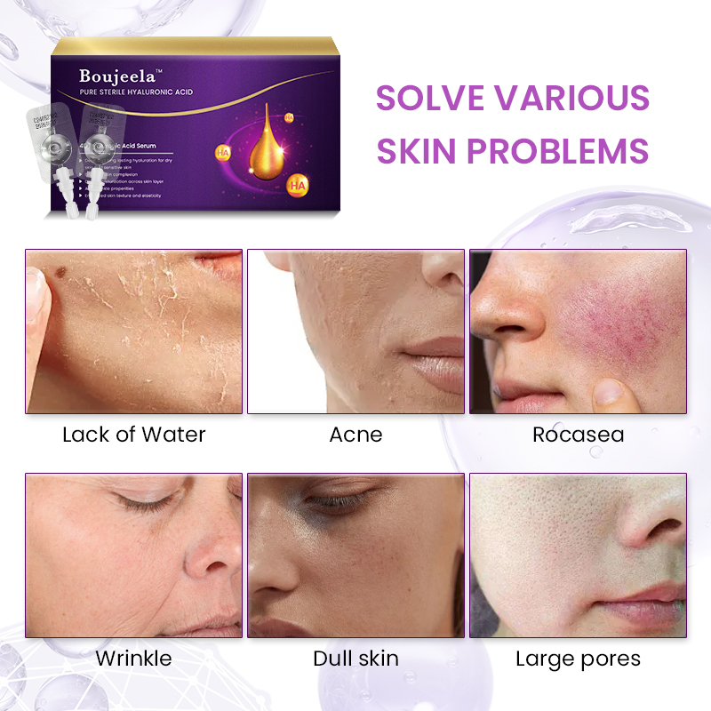 Injectable Pure 4D Hyaluronic Acid Serum 10vials/box