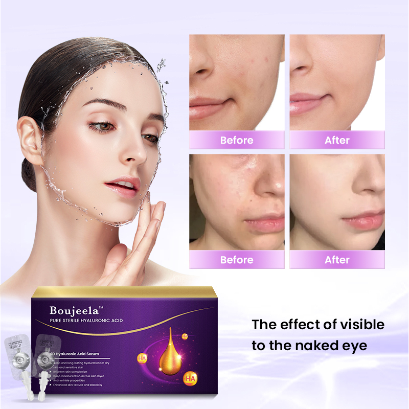 Injectable Pure 4D Hyaluronic Acid Serum 10vials/box