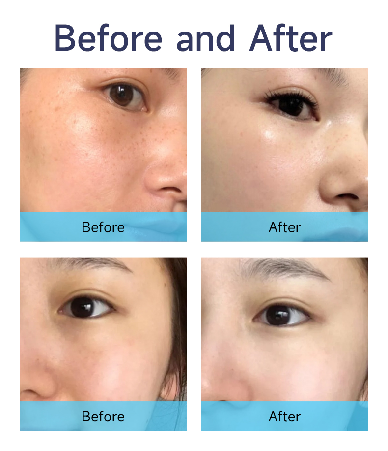 Meso Secret Exosomes for Cell Revival Skin Regeneration