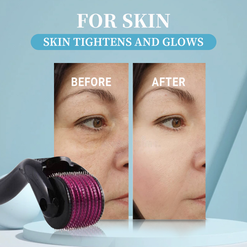 Dermal Roller 540 Microneedle for Hair Growth Remove Wrinkles